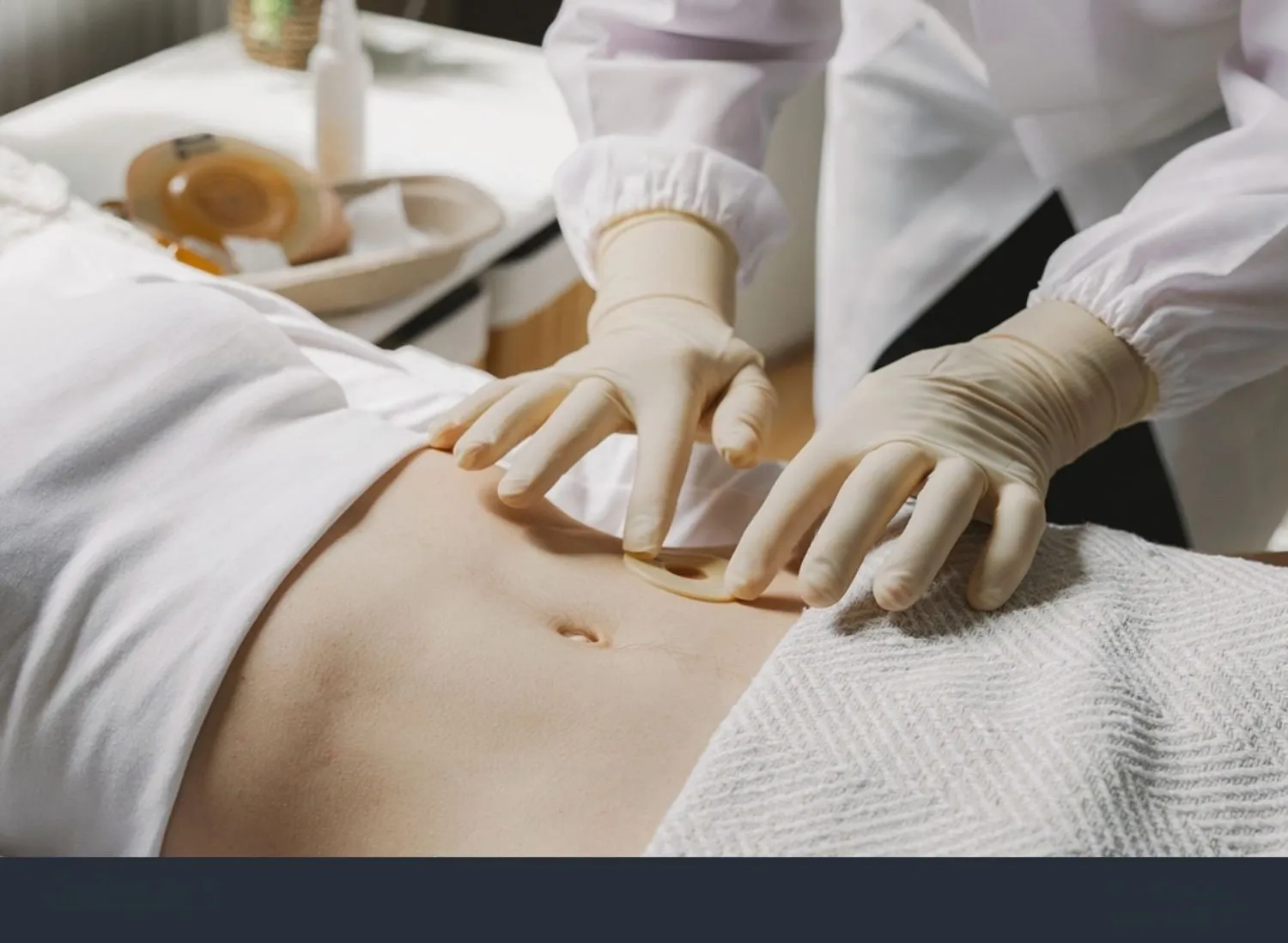 Manejo de Colostomías a domicilio Bucaramanga